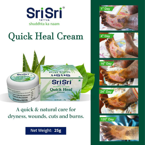 Sri Sri Tattva Quick Heal Cream 25g